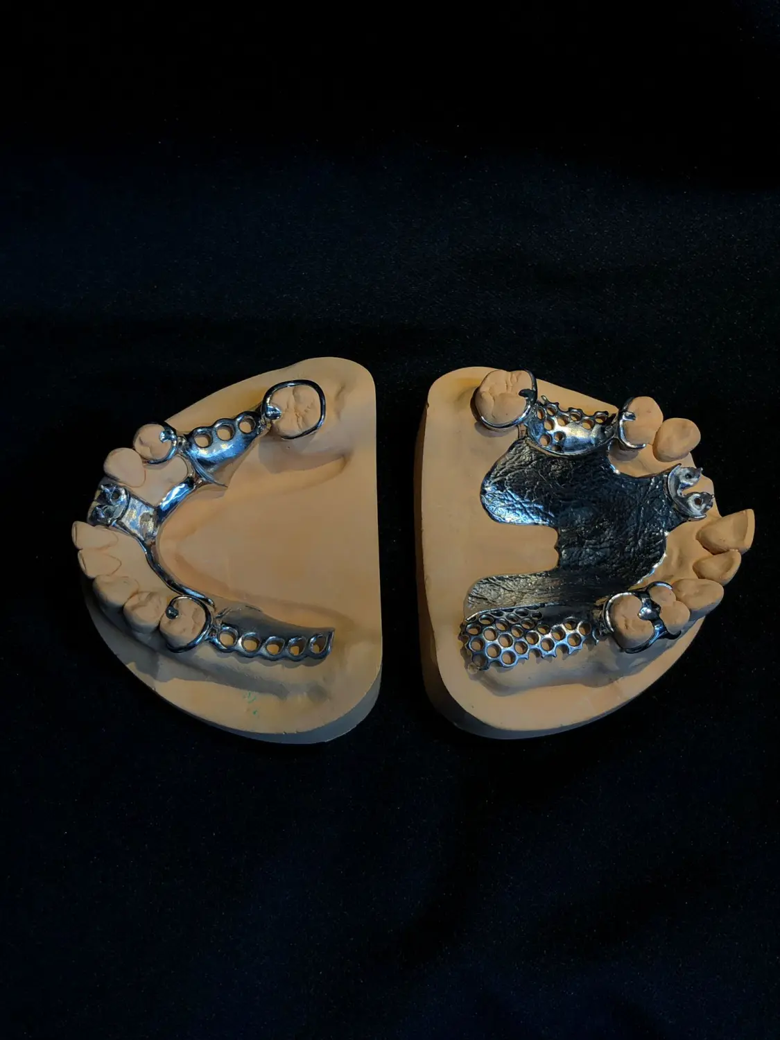 Gefräste Restauration aus Kobalt-Chrom von Dental Ästhetik Eberhardt Gmbh