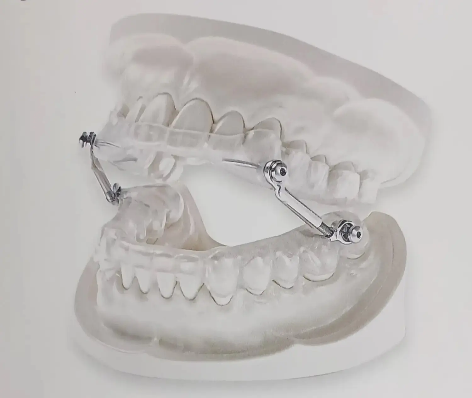 Schnarcherschiene und Aufbissschienen von Dental Ästhetik Eberhardt GmbH