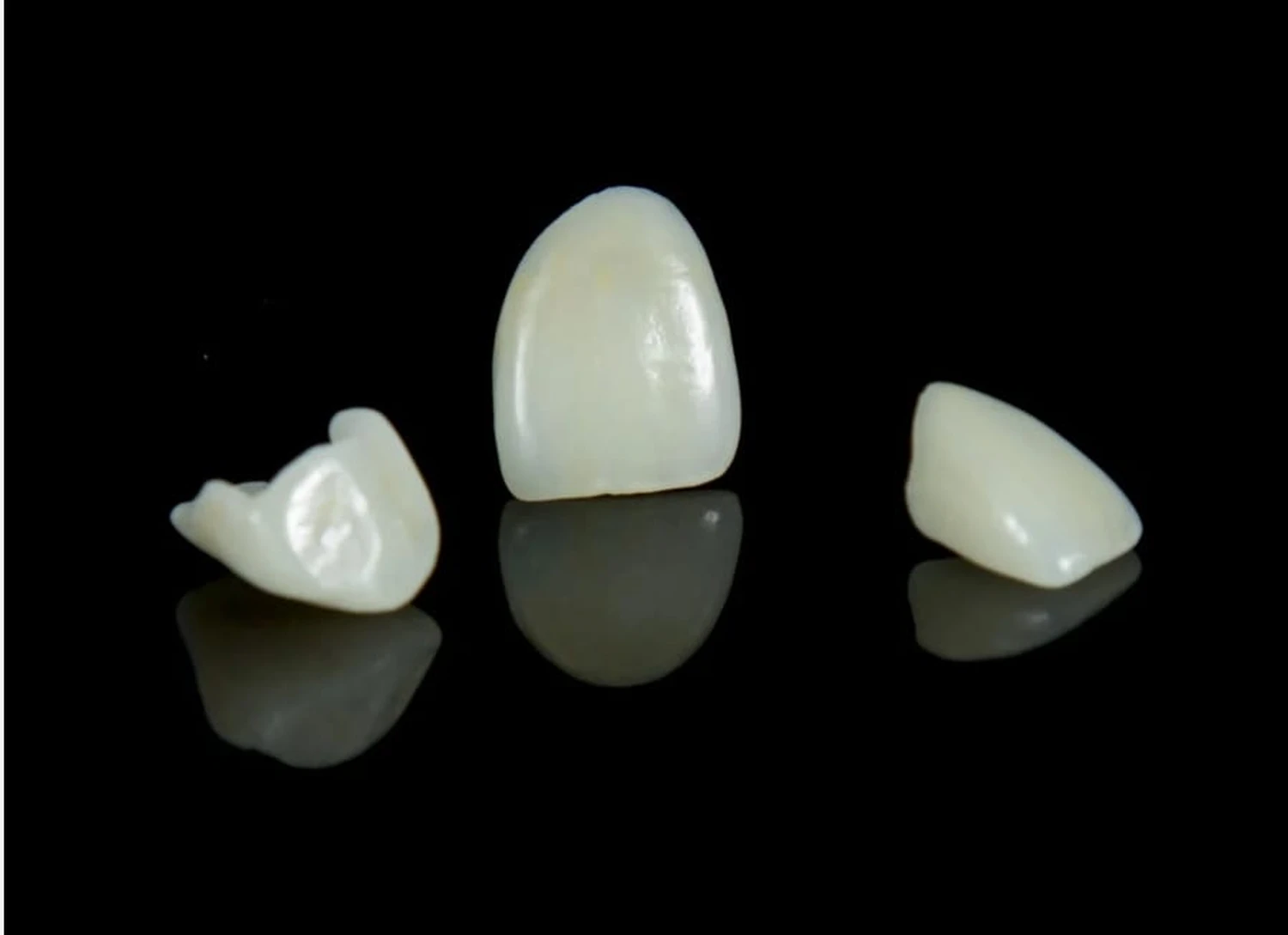 Veneers von Dental Ästhetik Eberhardt GmbH
