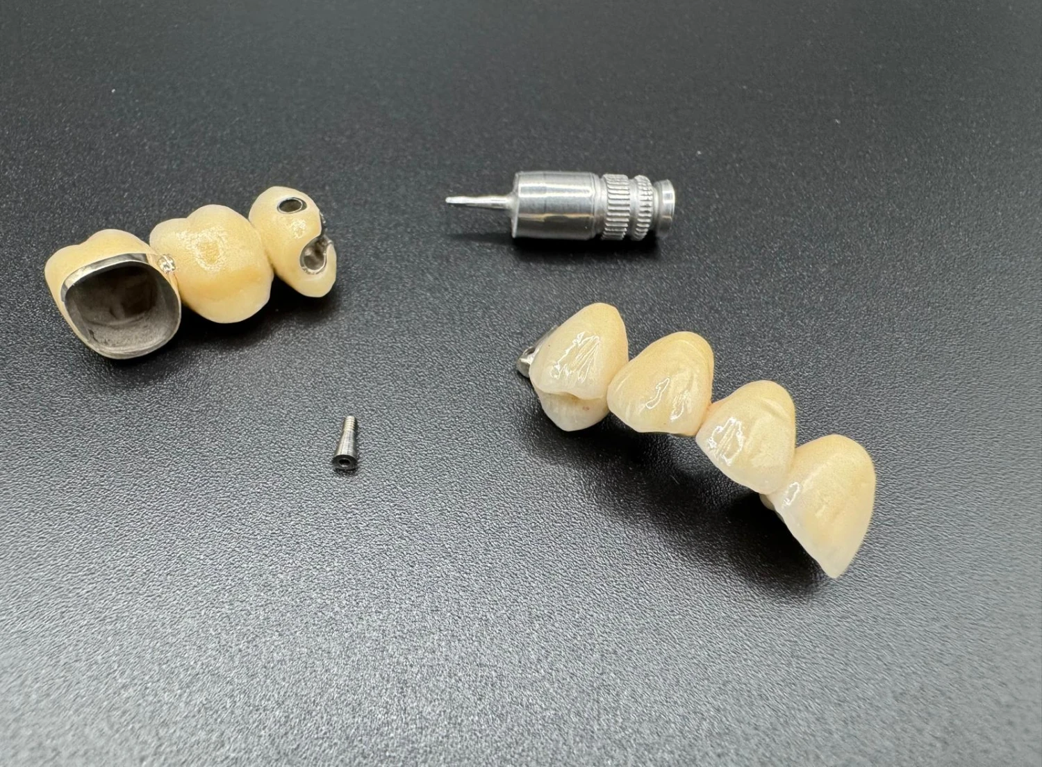 Kronen- und Brückenprothetik von Dental Ästhetik Eberhardt GmbH