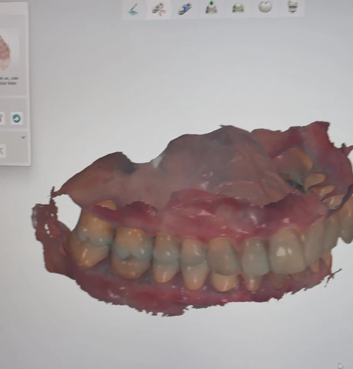 Intraoralscan von Dental Ästhetik Eberhardt GmbH