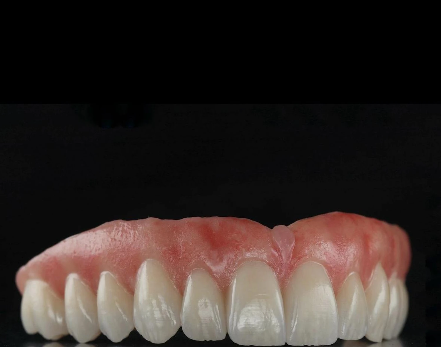 Totalprothesen der Dental Ästhetik Eberhardt GmbH