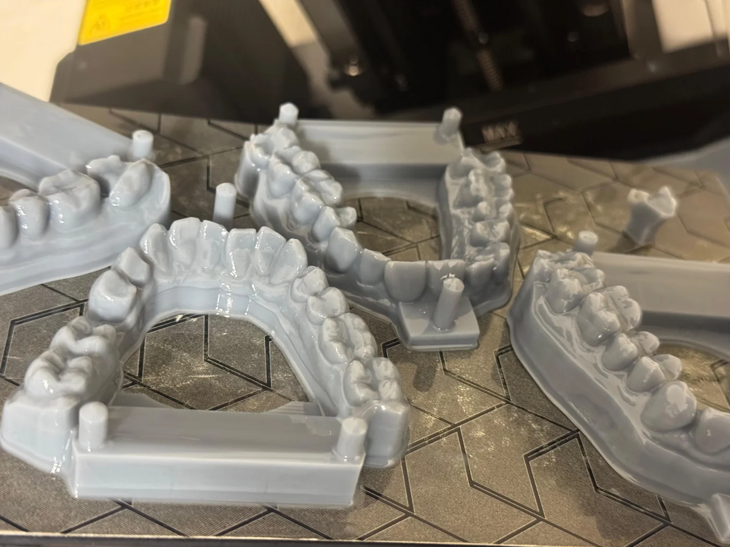 3D-Drucktechnik von Dental Ästhetik Eberhardt GmbH